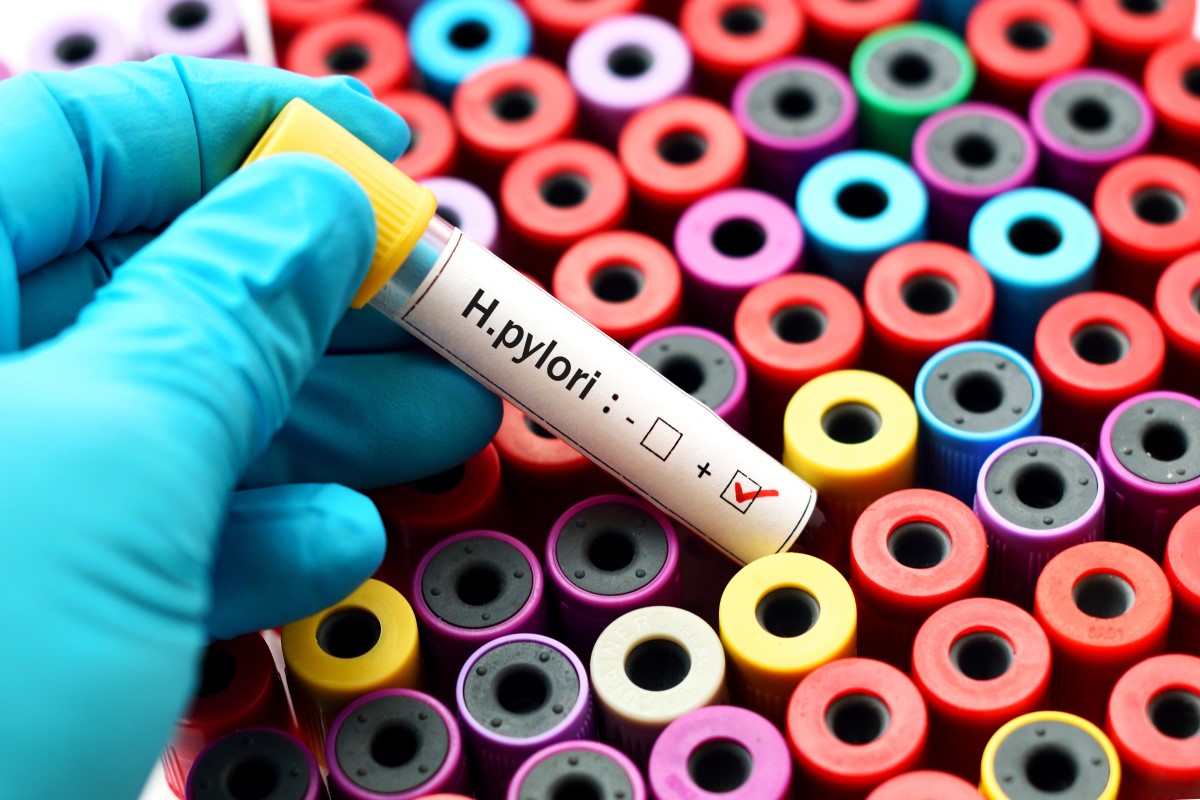 Colheita de sangue para HP, tubo