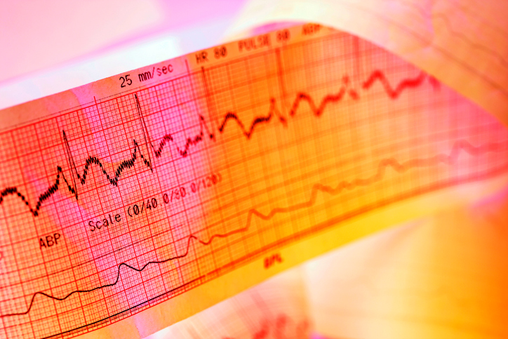 O registo da monitorização do ECG é importante. Foto: Thinkstock Registo ECG