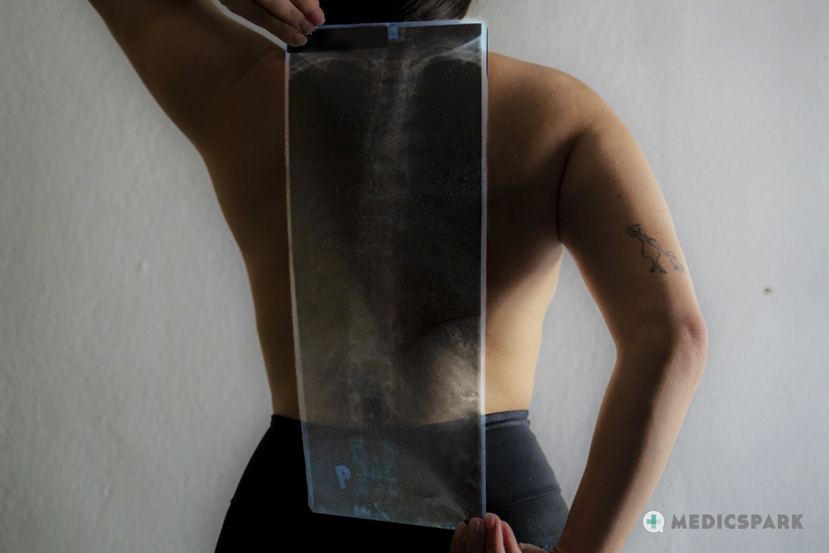 Também complicam a dor lombar: Getty Images Dores de costas
