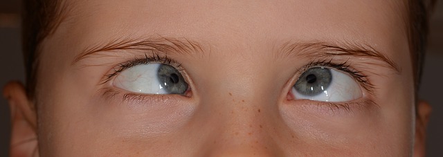 Conhecemos várias formas de estrabismo, num ou em ambos os olhos. Fonte foto: Getty Images o rapaz tem um distúrbio do movimento ocular, semicerrando os olhos