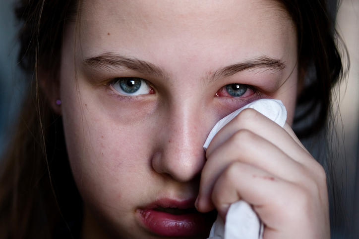 a rapariga tem inflamação ocular, inchaço ocular, vermelhidão ocular, mão, lenço