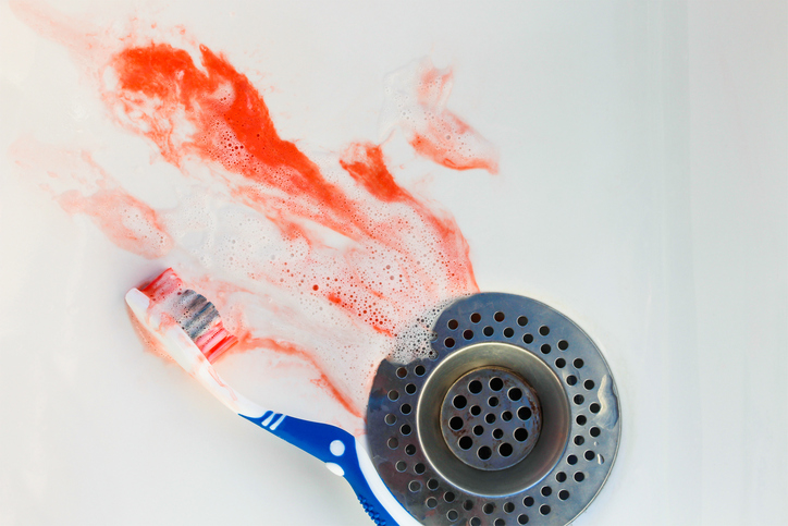 A causa pode ser uma higiene oral inadequada: Getty Images Sangramento das gengivas, lavatório, sangue, pasta de dentes, escova de dentes, higiene oral incorrecta, escovagem incorrecta