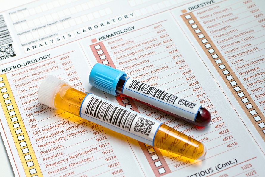 Exame laboratorial de amostras de urina e sangue de um doente. Fonte da fotografia: Getty Images Exame laboratorial da urina e da amostra de sangue do paciente.