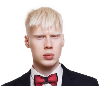 jovem albino do sexo masculino, cabelo branco, vestindo um casaco