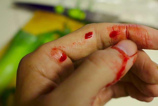 O sangue fora dos vasos sanguíneos seca rapidamente, as células sanguíneas desintegram-se. Foto de origem: Getty Images Mão, sangue, sangramento, ferimento