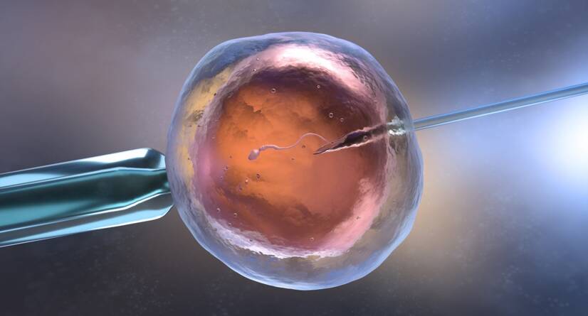 Fertilização in vitro FIV Fonte: Getty Images