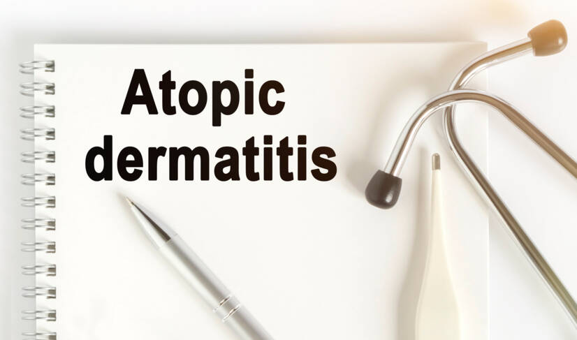 Eczema atópico: o que é, porque é que surge e quais são os seus sintomas?
