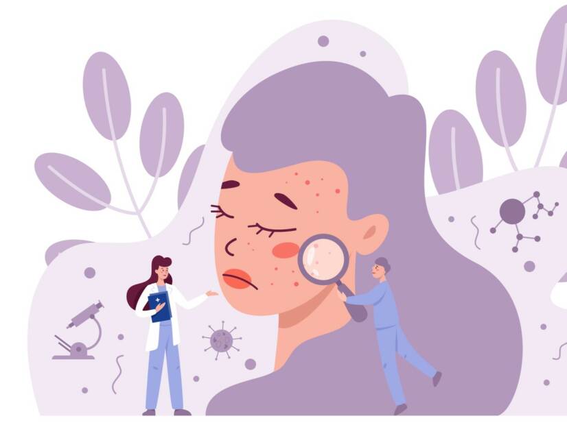 Carcinoma basocelular: Qual é o aspeto do basalioma e porque é que ocorre?