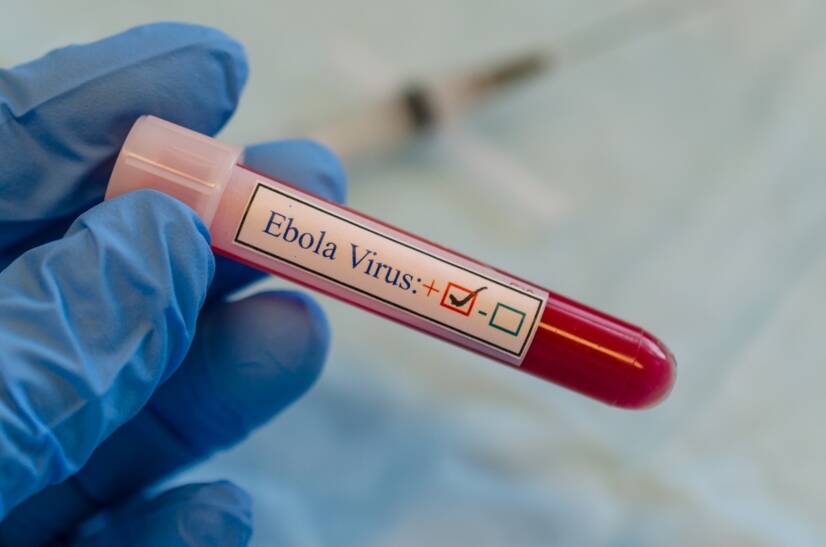 Ébola: Quais são os sintomas?