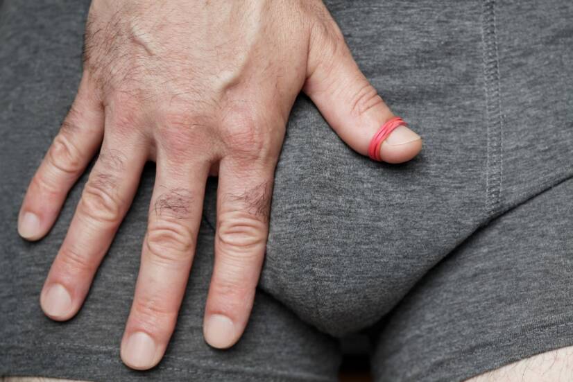 Fimose e parafimose (estreitamento do prepúcio): quais são as causas e os sintomas?