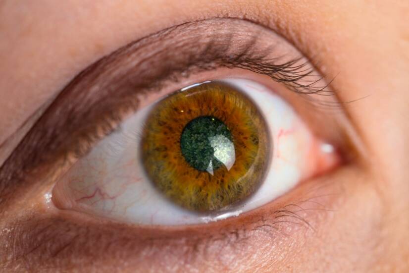 Glaucoma ou glaucoma: quais são as suas causas, sintomas e tratamento?