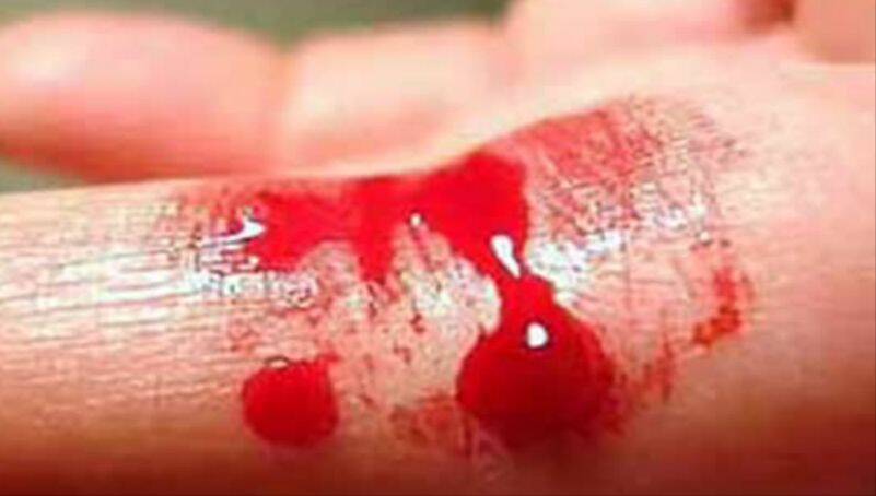 Hemofilia: o que é e como se manifesta? Conhece as causas da doença real?