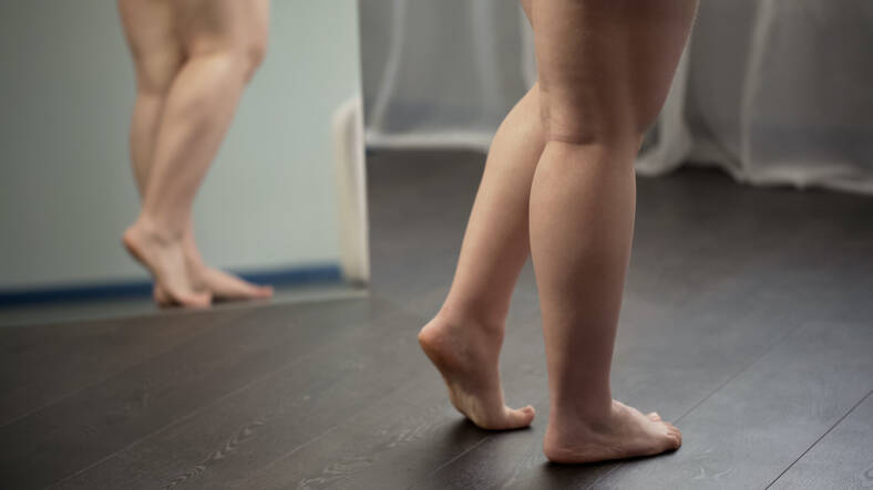 Trombose venosa profunda: o que é, porque é que ocorre e quais são as suas complicações?