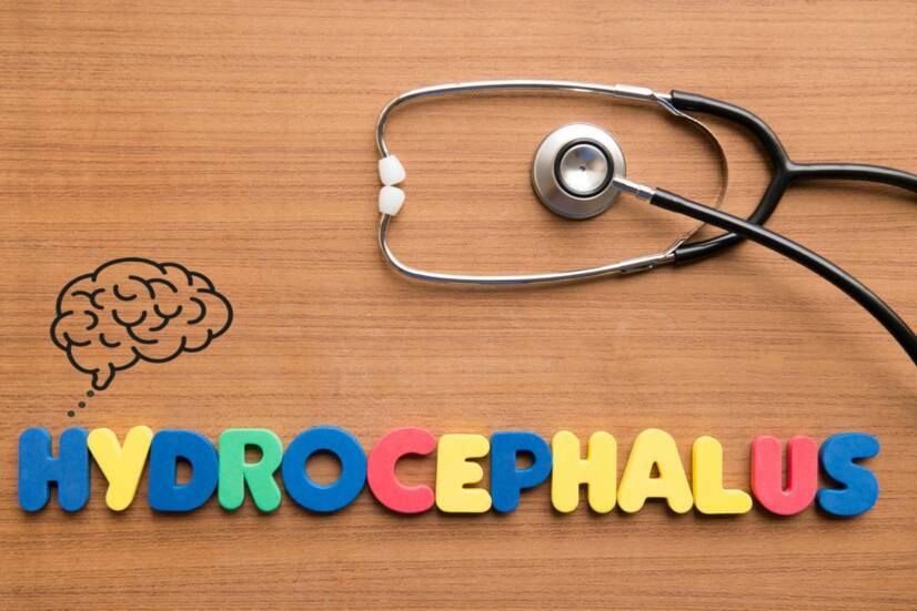 Hidrocefalia: O que é e porque é que ocorre? Quais são os sintomas e as consequências?