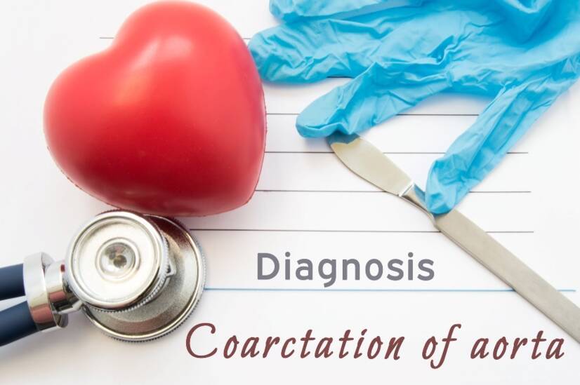 Coartação da aorta: causas e sintomas de estreitamento da aorta?