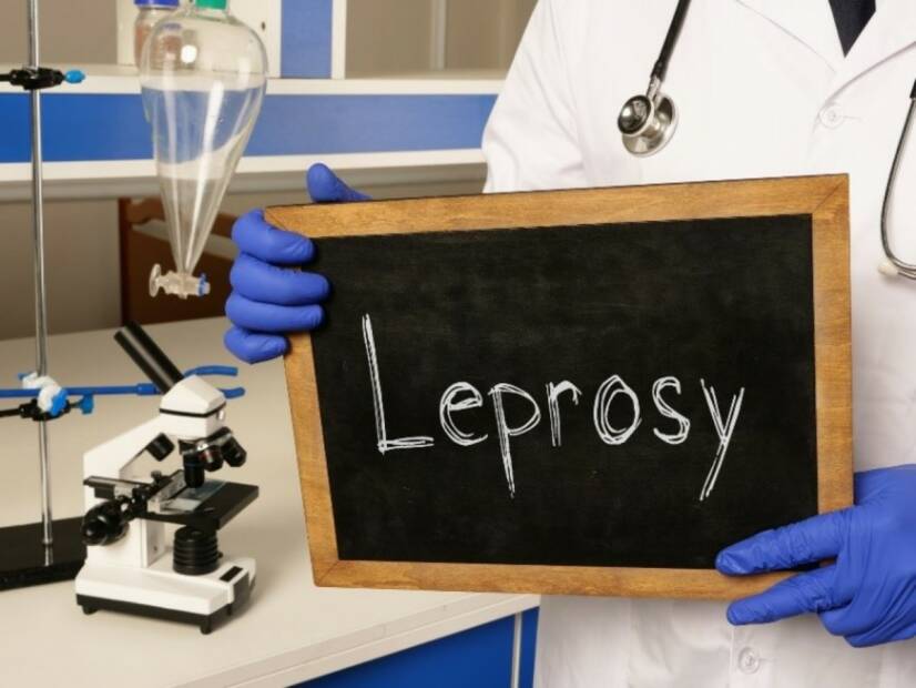 Lepra: O que é a lepra, como ocorre e quais são os seus sintomas?