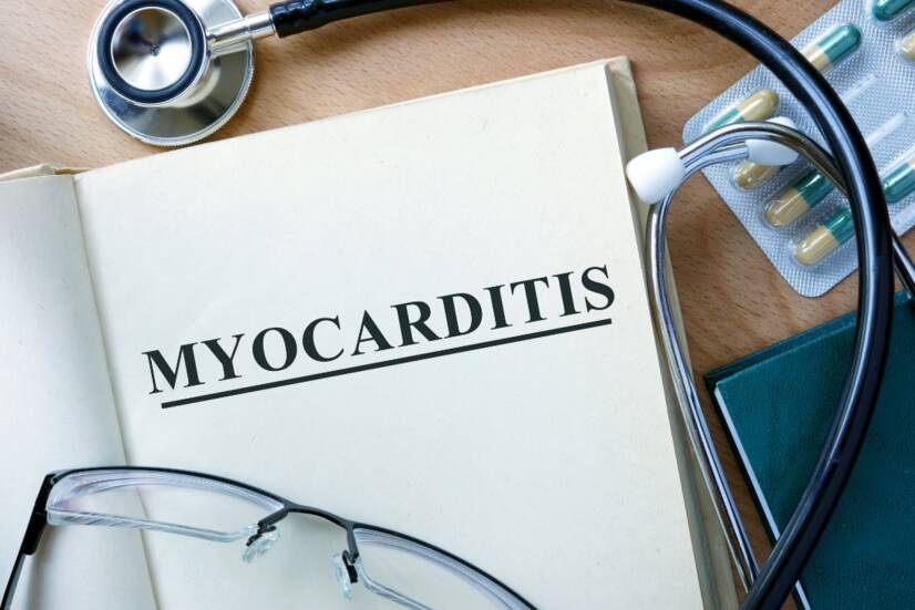 Miocardite: inflamação do músculo cardíaco. Enfarte do miocárdio, um tipo de doença cardíaca