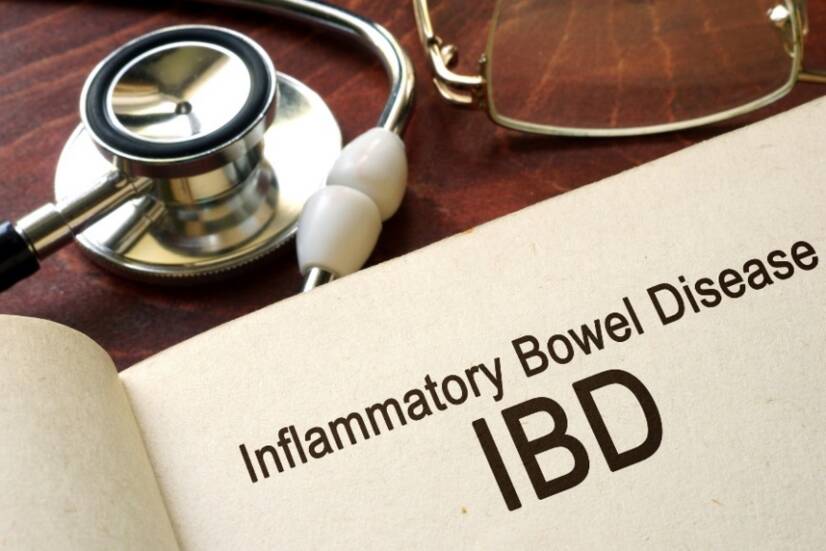 Doença inflamatória intestinal não específica, DII: Quais são os tipos e os sintomas?