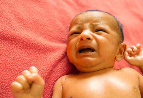 Quando é que a iterícia neonatal é perigosa? O que é e porque é que a iterícia surge nos recém-nascidos?
