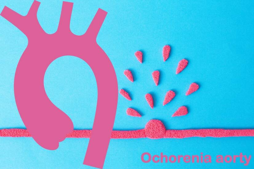 Doença da aorta: aneurisma, dissecção e outras? Conheça as causas, os sintomas