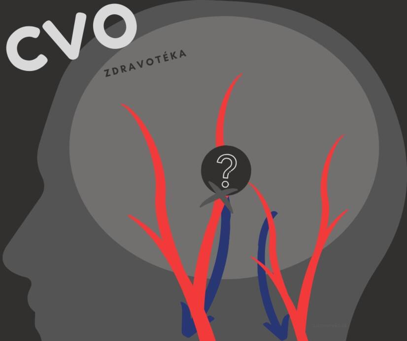 Doença cerebrovascular: enfraquecimento, estreitamento ou dilatação dos vasos sanguíneos cerebrais? Conheça as causas e os sintomas