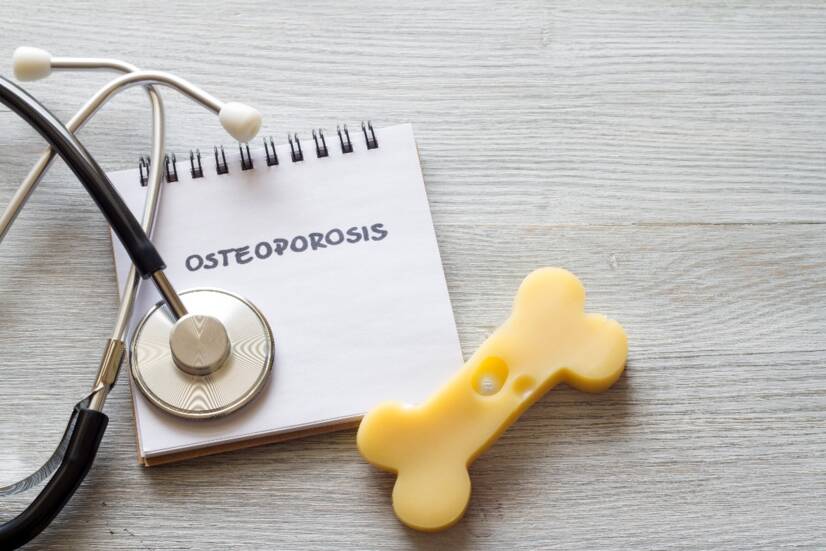 OSTEOPOROSE: Quando os ossos enfraquecem e o tratamento é difícil. Quais são as causas, os sintomas e as consequências + dicas de prevenção?
