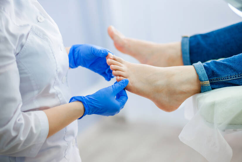 Micose das unhas, fungos nos pés e nas unhas: manifestações e remoção?