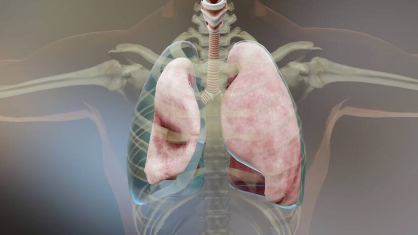 Pneumotórax (ar no peito): causas, sintomas e primeiros socorros