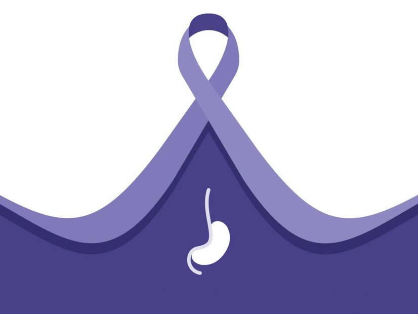 Cancro do esófago: porque ocorre, como se manifesta e como é tratado?
