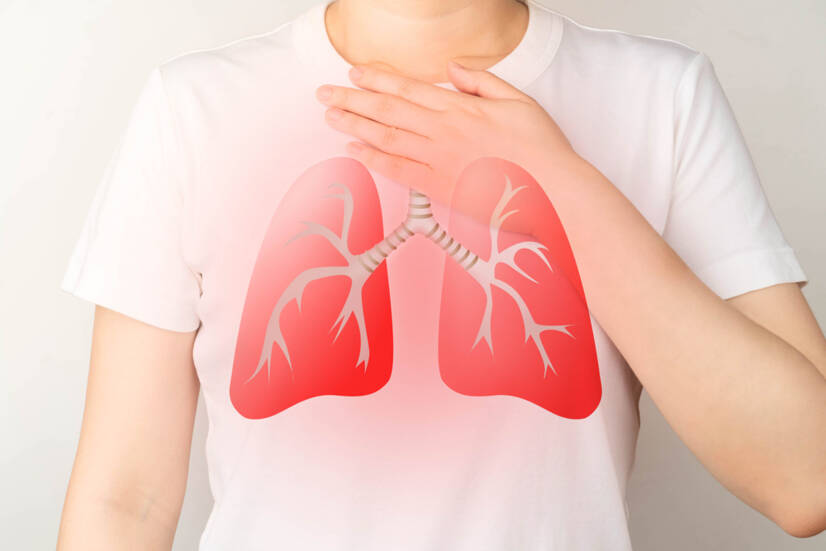 Pneumonia: que sintomas tem a pneumonia e como se divide?