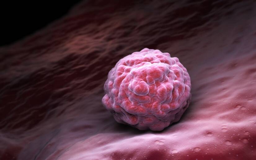 Aninhamento do embrião no revestimento uterino, foto de origem: Getty Images