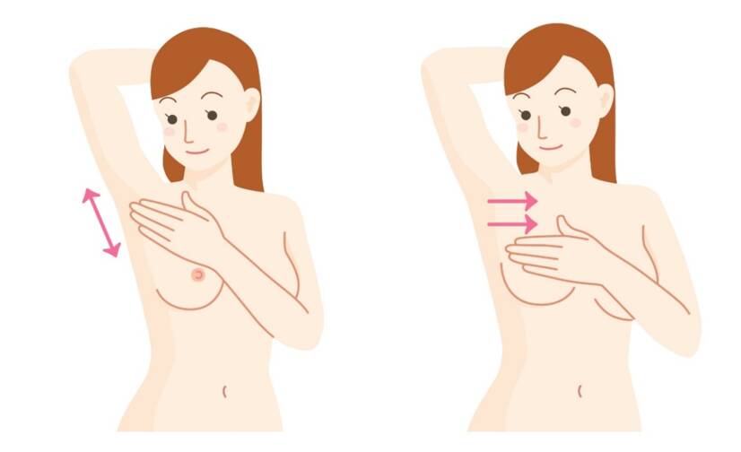 Auto-exame da mama: como prevenir e cuidar da saúde da mama?