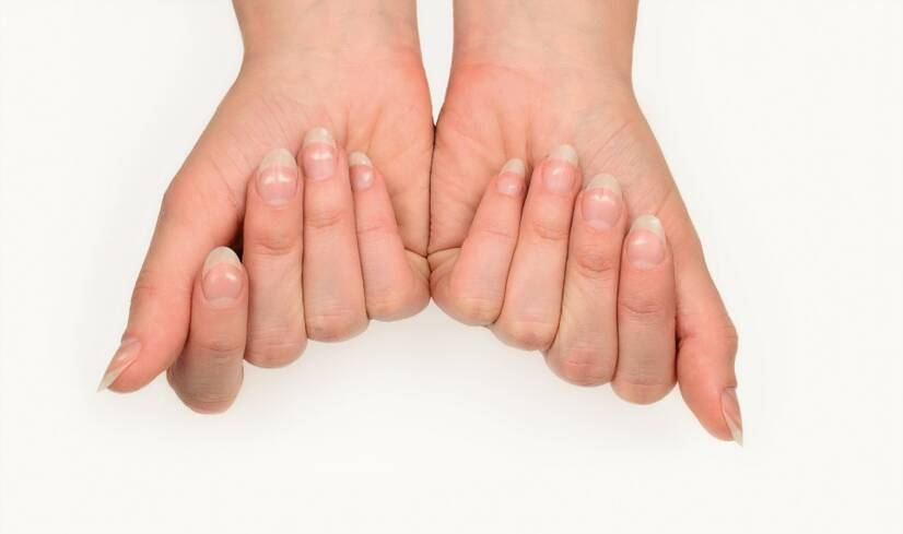 Manchas brancas nas unhas: o que significam e quais são as causas?