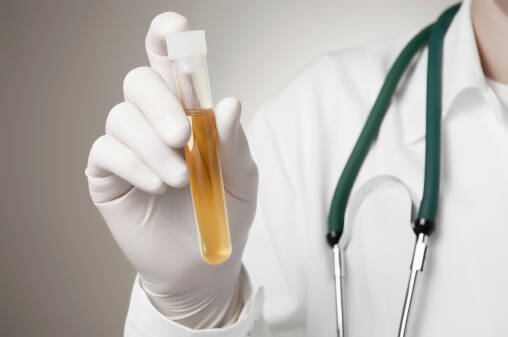 O que significa a presença de proteínas na urina? Proteinúria mesmo na infância ou na gravidez