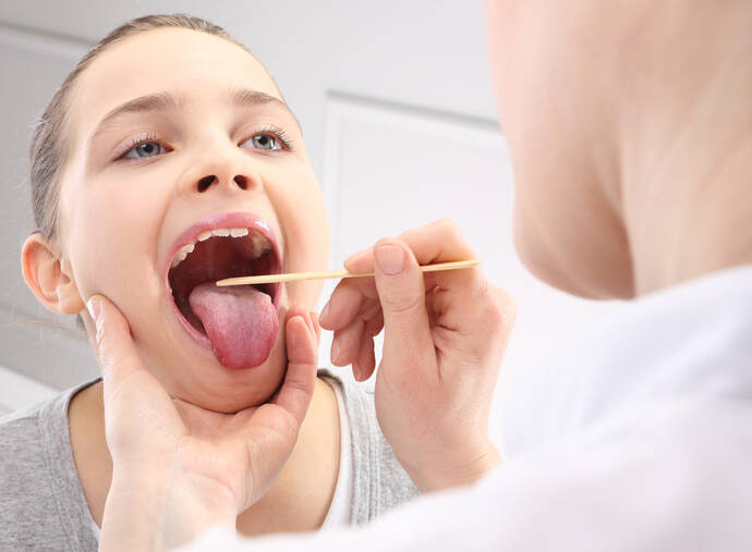 Pinos nas amígdalas: o que são os nódulos brancos (caroço, pus) e como removê-los?