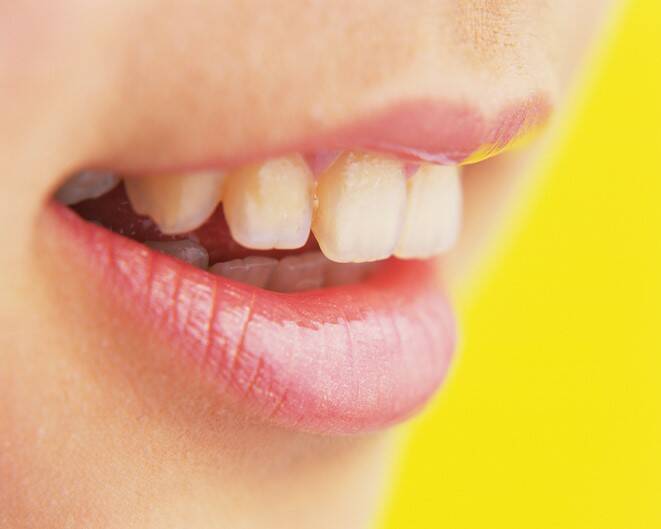 Dentes a abanar: quais são as causas (em adultos e crianças)?