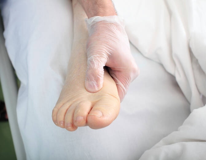 Inchaço (edema) dos membros: o que causa o inchaço das mãos, dos pés e dos tornozelos?