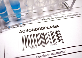 Acondroplasia - Quais são as causas e os sintomas de uma doença óssea congénita?