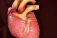 Tetralogia de Fallot: O que é e como se manifesta esta malformação congénita?
