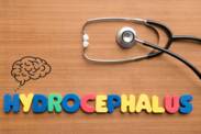 Hidrocefalia: O que é e porque é que ocorre? Quais são os sintomas e as consequências?