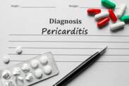 Pericardite: inflamação do revestimento do coração. Quais são as suas causas e sintomas?