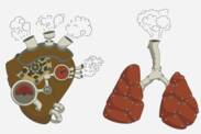 Hipertensão pulmonar: o que é e porque surge + Sintomas e tratamento