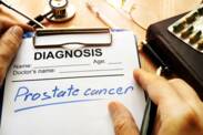Cancro da próstata: causas e primeiros sintomas. Qual é o prognóstico do tratamento?