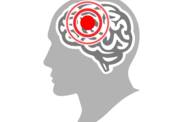 Meningite tuberculosa: o que é e que sintomas apresenta?