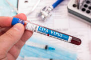 Vírus Zika: o que é, como se transmite e quais são os sintomas?