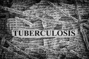 A tuberculose não é uma coisa do passado, mata milhões de pessoas todos os anos