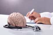 Bem-vindo ao neurologista: os diagnósticos mais comuns no ambulatório de neurologia