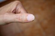 As unhas quebradiças e as suas principais causas? Como combatê-las?