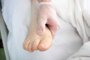 Inchaço (edema) dos membros: o que causa o inchaço das mãos, dos pés e dos tornozelos?