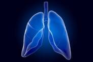 Edema pulmonar: Porque é que o edema pulmonar ocorre? É uma causa comum de morte?